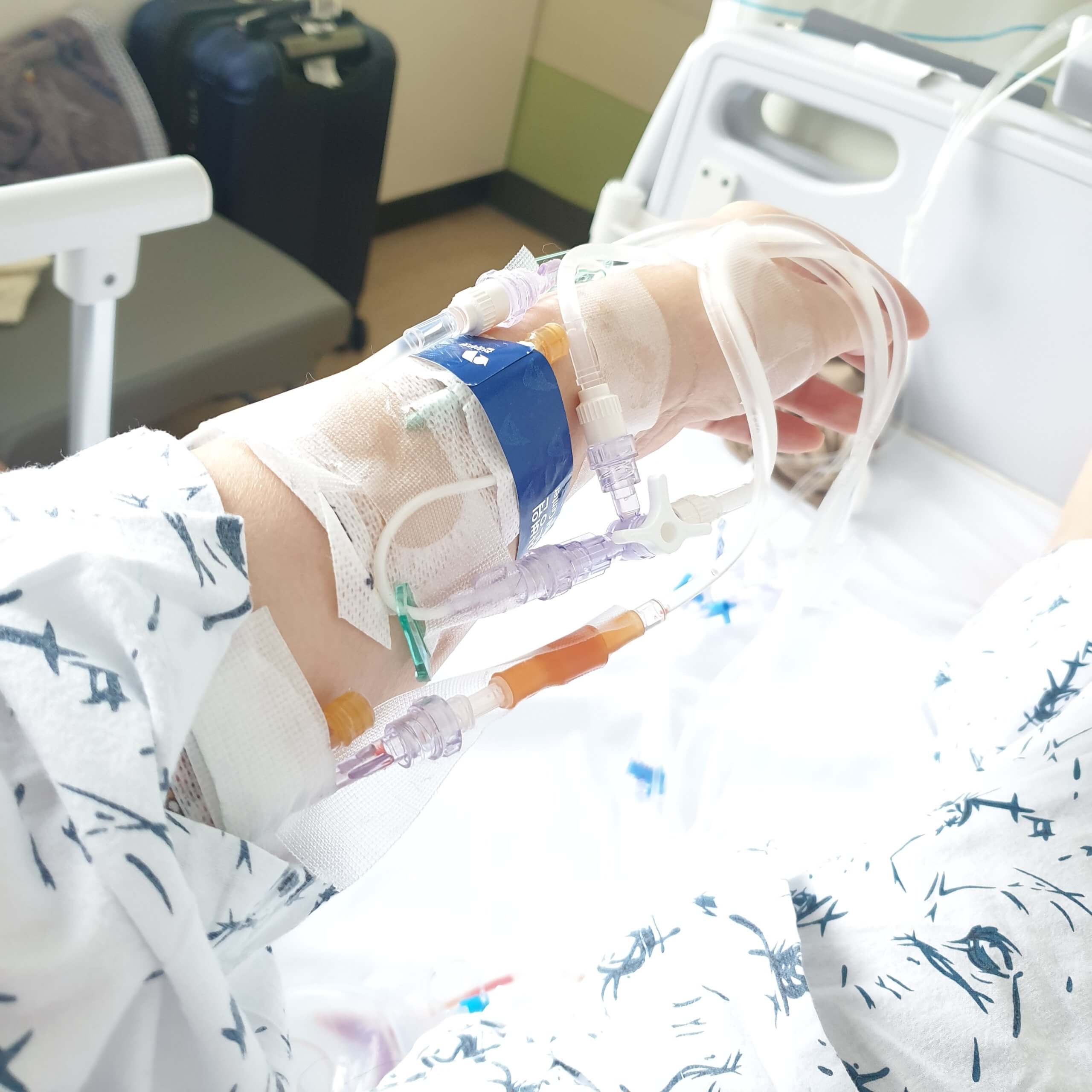 췌장 SPN 고형가유두상종양 로봇수술 후 팔에 꽂혀있는 주사바늘들