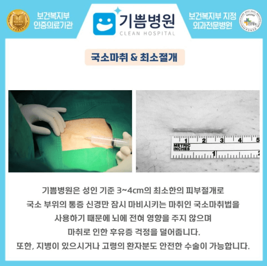 기쁨병원-국소마취